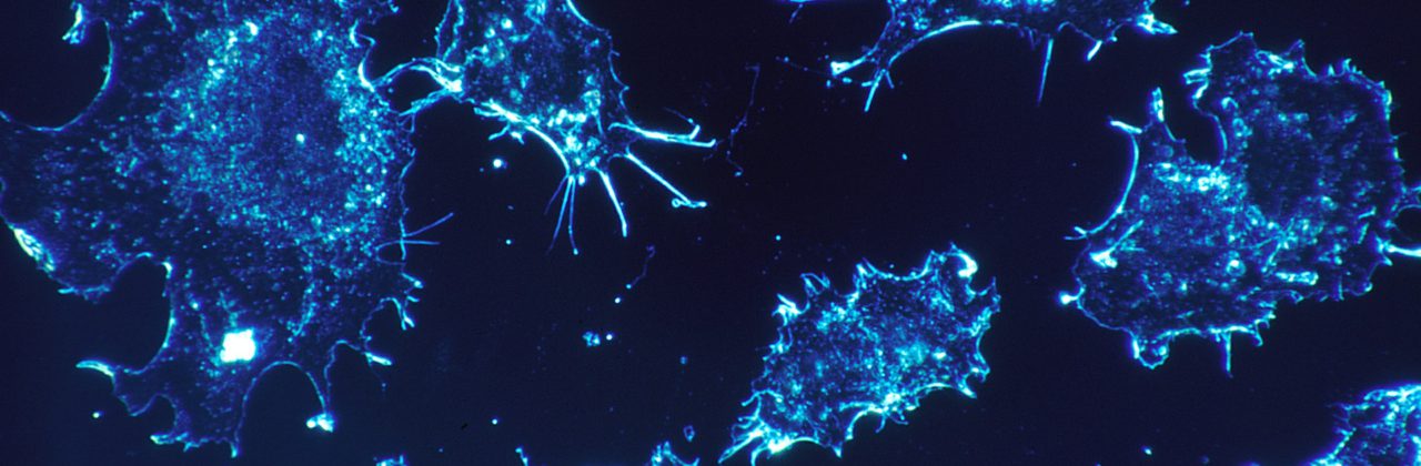 Übergewicht Risikofaktor für Krebs